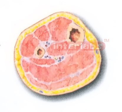 TRANSVERSE SECTION MODEL THROUGH THE MIDDLE 1/3 OF THE RIGHT LEG (B)